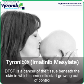 DFSP is a cancer of the tissue beneath the skin in which some cells start growing out of control